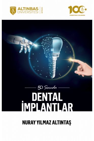 50 Soruda Dental İmplantlar