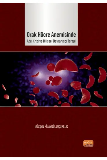 Orak Hücre Anemisinde Ağrı Krizi ve Bilişsel Davranışçı Terapi - Klinik Psikoloji - Cosmedrome